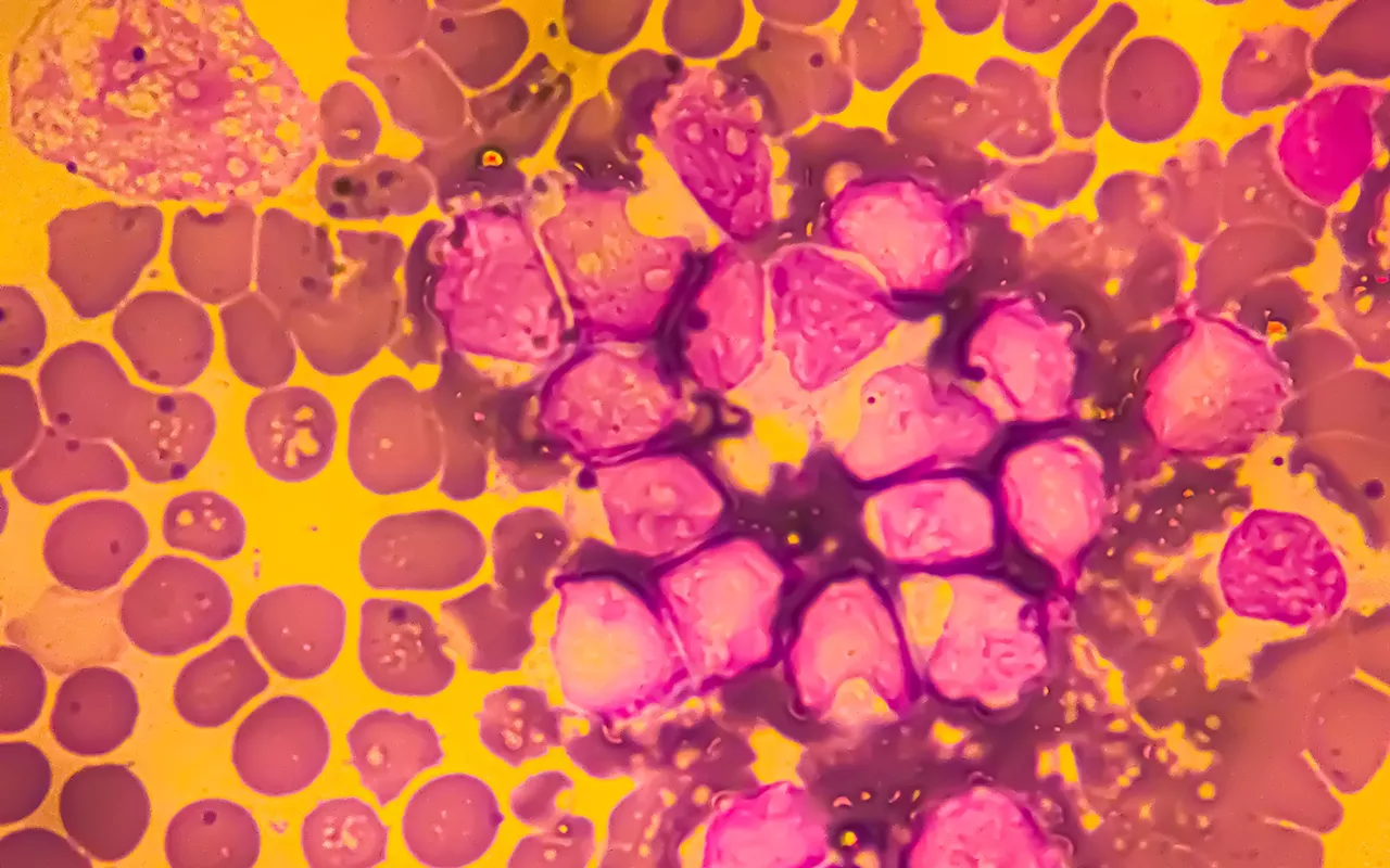 Image: UIS researchers partner with SIU School of Medicine to study how cancer spreads